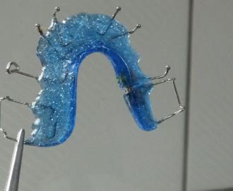 aparat dentar din safir