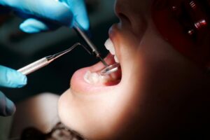 Problemele dentare